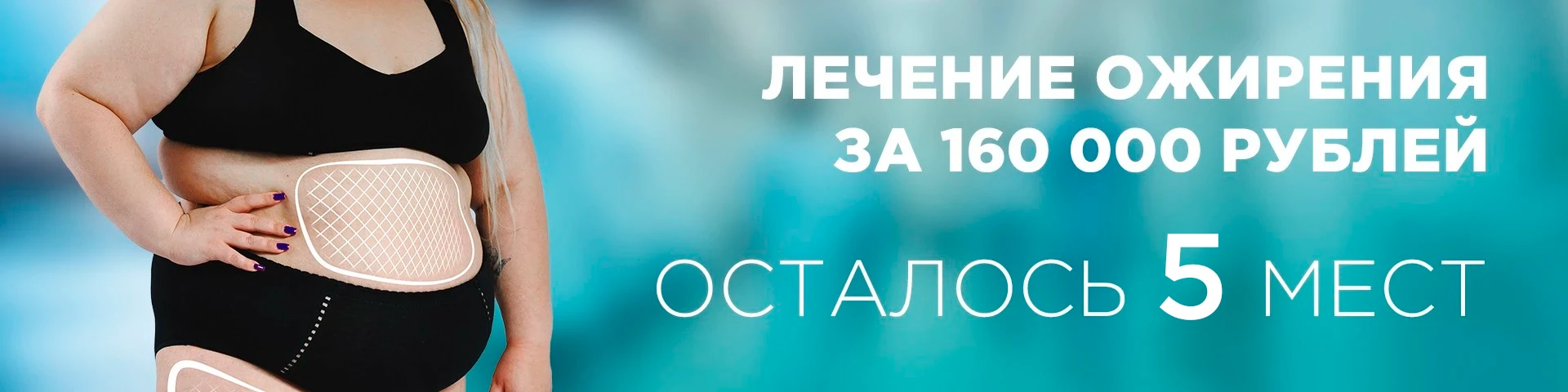Хирургическое лечение ожирения "Под ключ"